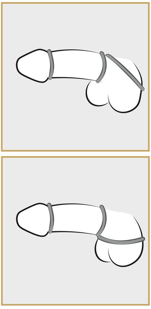 Penisring-Set in Metall-Optik (3-teilig)