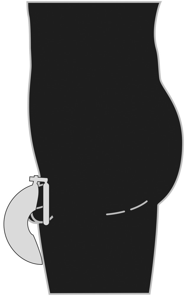 Gebogener Peniskäfig mit Hodenring